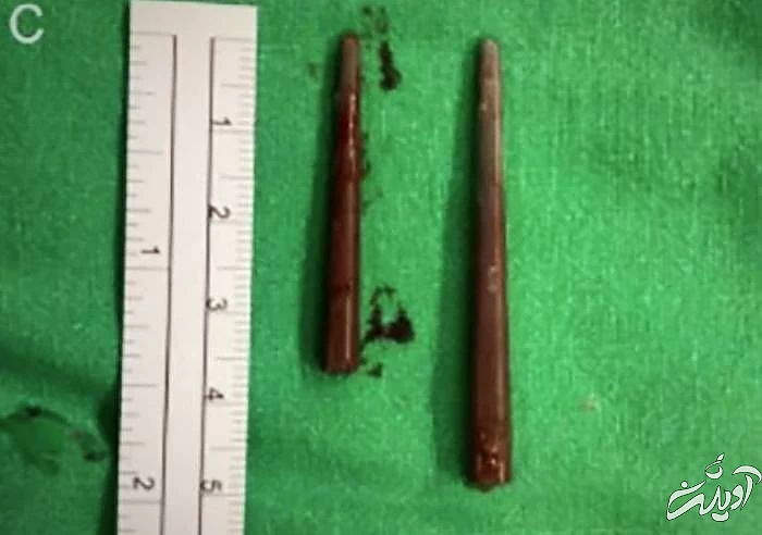 در آوردن چاپ استیک